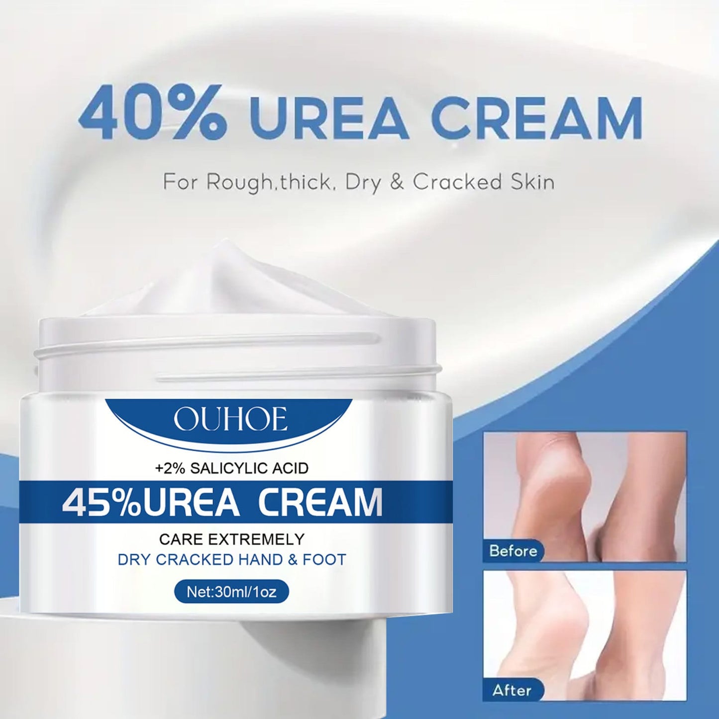 UREA CREAM™ - CREMA PARA TALONES AGRIETADOS ⭐⭐⭐⭐⭐