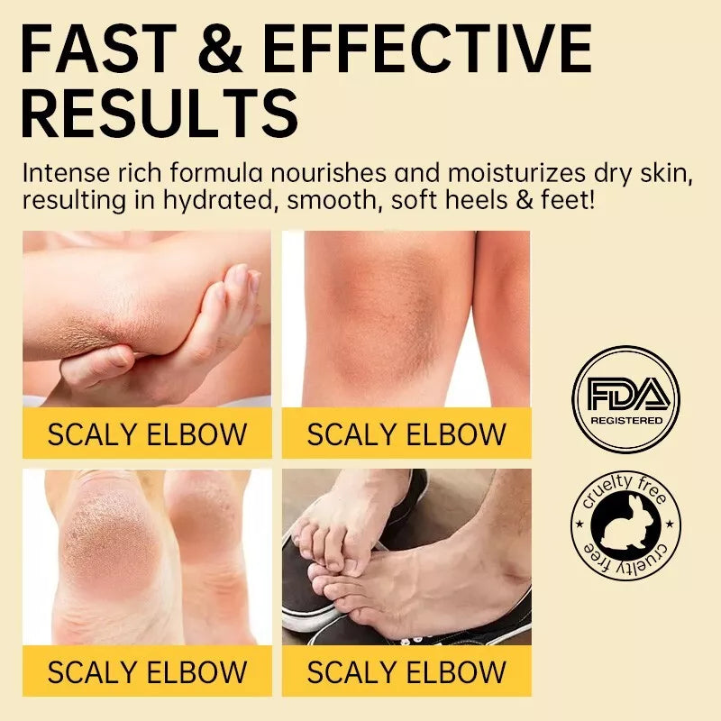FOOT CARE™ ⭐⭐⭐⭐⭐ ELIMINA LAS GRIETAS DE TUS PIES