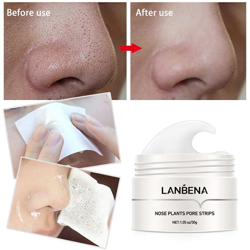 LANBENA™ ⭐⭐⭐⭐⭐- ELIMINADOR DE ESPINILLAS Y ACNE