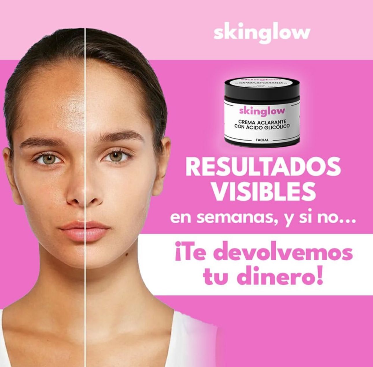 CREMA ACLARANTE SKINGLOW™⭐⭐⭐⭐⭐ ELIMINA LAS ZONAS MAS OSCURAS DE TU PIEL