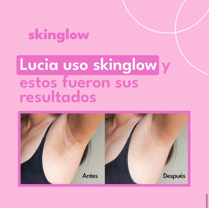 CREMA ACLARANTE SKINGLOW™⭐⭐⭐⭐⭐ ELIMINA LAS ZONAS MAS OSCURAS DE TU PIEL