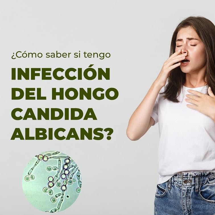 ORÉGANO ORGANICO ORE ™ ⭐⭐⭐⭐⭐ ELIMINA LA SINUSITIS, ALERGIAS Y COLICOS